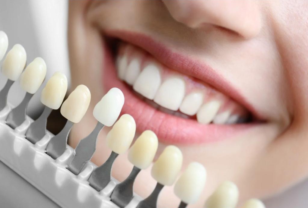 <a href='#' class='popup-clareamento'>Clareamento Dental</a>