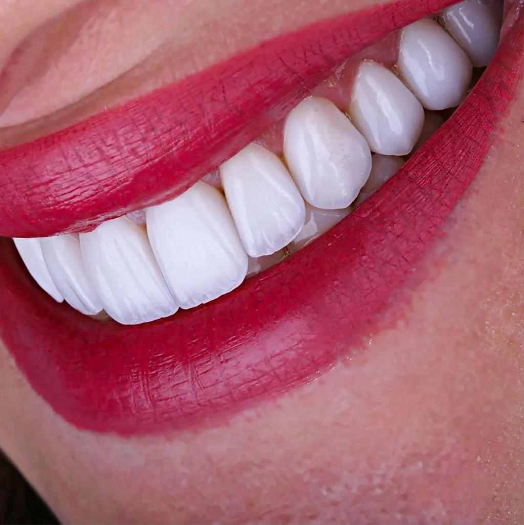<a href='#' class='popup-facetas'>Facetas de Resina</a>